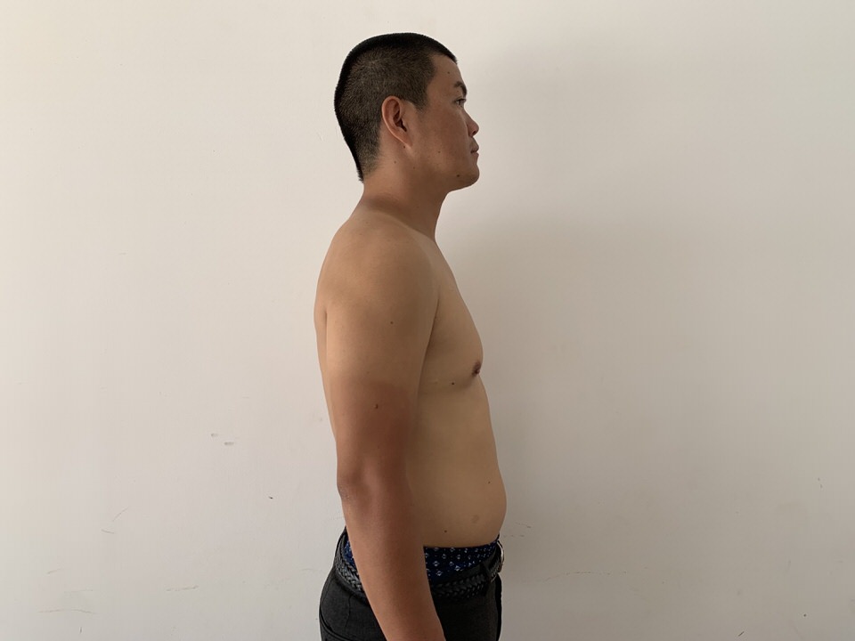 アブローラー開始1ヶ月後の横からの変化